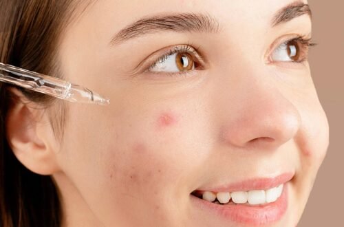 Smiling young woman applying acne treatment serum on face