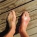 feet, gout, pain, foot, human, anomaly, barefoot, flatfoot, toes, ankle, sole, brown pain, brown human, gout, gout, gout, gout, gout, pain, foot